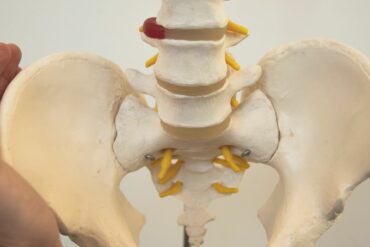 Myotherapy for Scoliosis